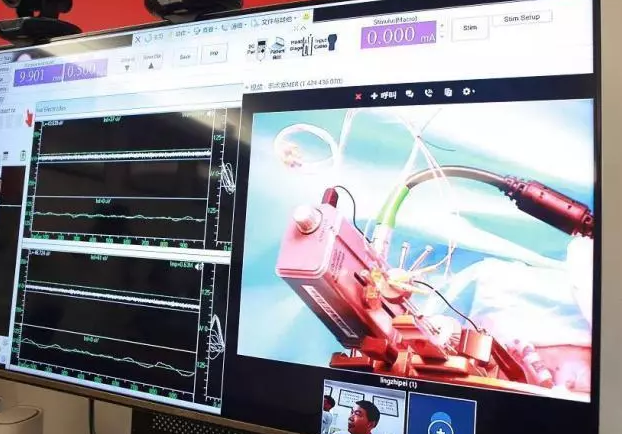 图片[3]-索尼大屏新机曝光 ﻿腾讯服务器大宕机 中国移动携华为完成首例 5G 远程人体手术-质流